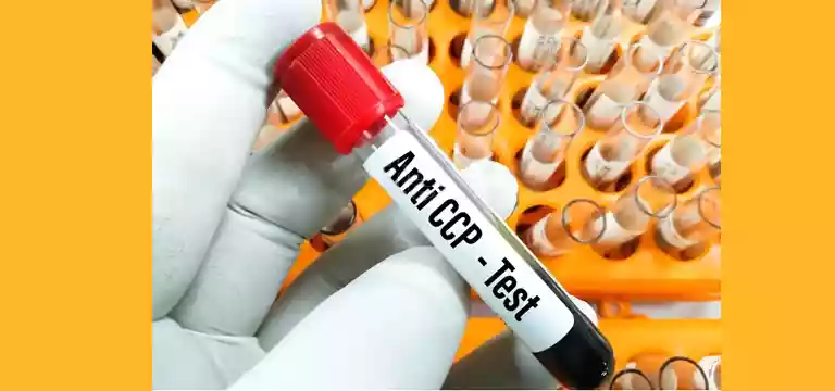 ccp antibody test